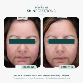 Marini SkinSolutions lotion texture close-up showing lightweight absorbency