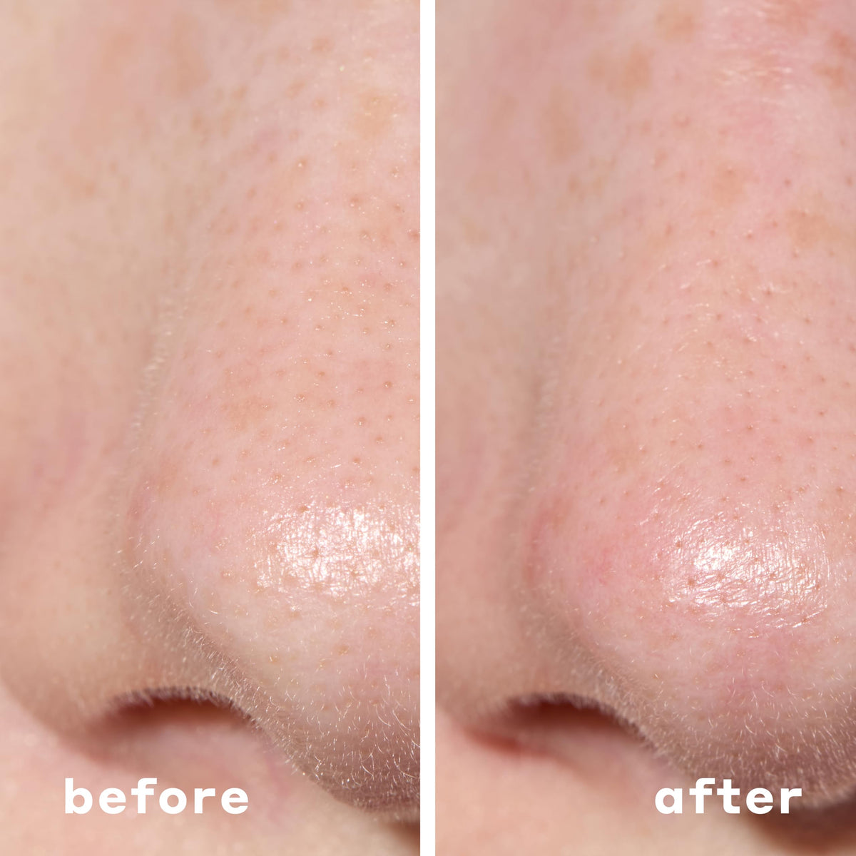 Mario Badescu patch applied to nose illustrating targeted pore care benefit