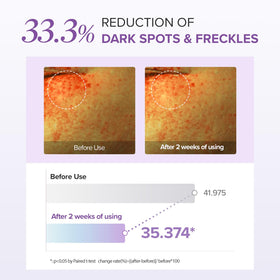 Applying Mary&May eye cream under eye for targeted brighter tone
