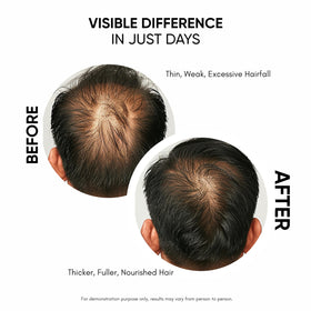 Masofta serum applied to scalp illustrating targeted application benefits