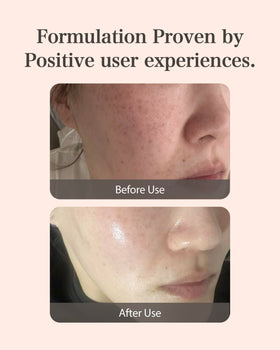 MASTINA on bathroom counter in nighttime routine for targeted evening use