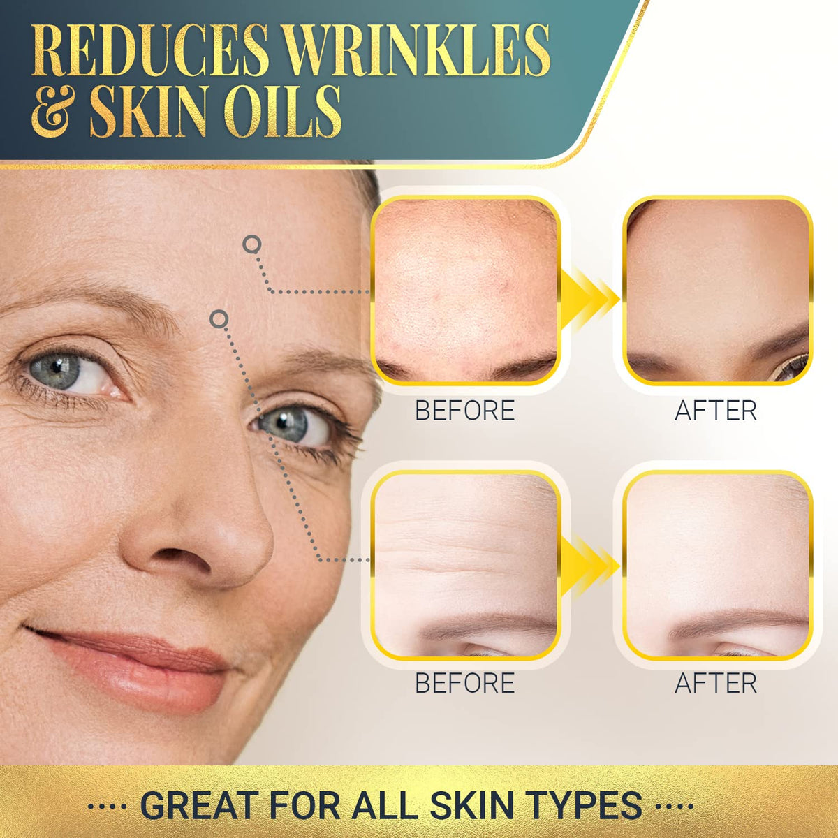 Matykos patch applied on forehead demonstrating smoothing effect