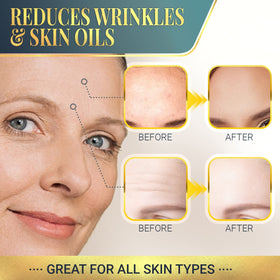 Matykos patch applied on forehead demonstrating smoothing effect