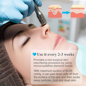 mcwdoit diamond tips array showing nine heads for customizable exfoliation