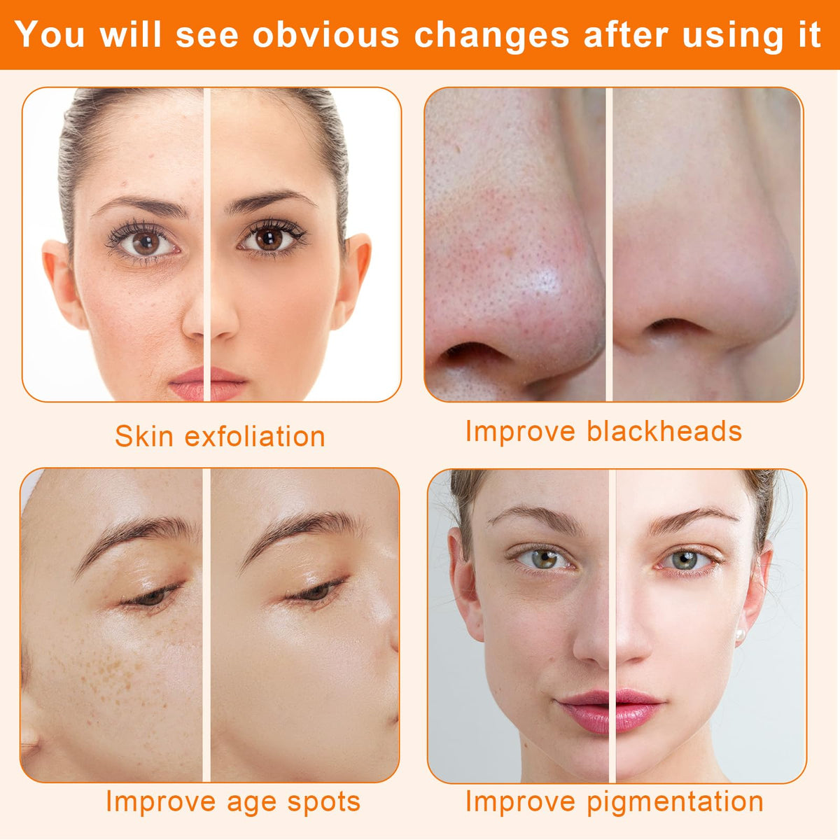 mcwdoit in use on cheek illustrating safe treatment and smoother-feeling skin benefit