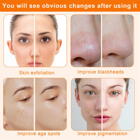 mcwdoit in use on cheek illustrating safe treatment and smoother-feeling skin benefit