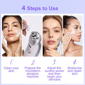 mcwdoit complete kit arranged with four tips for versatile treatment benefit