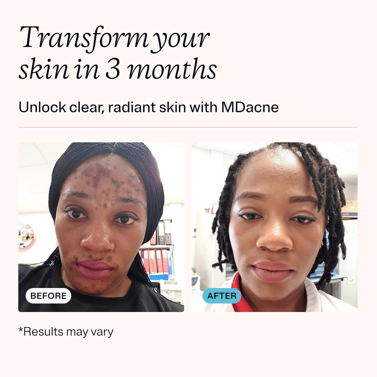 MDacne salicylic cleanser pump closeup demonstrating easy, non-drying cleanse