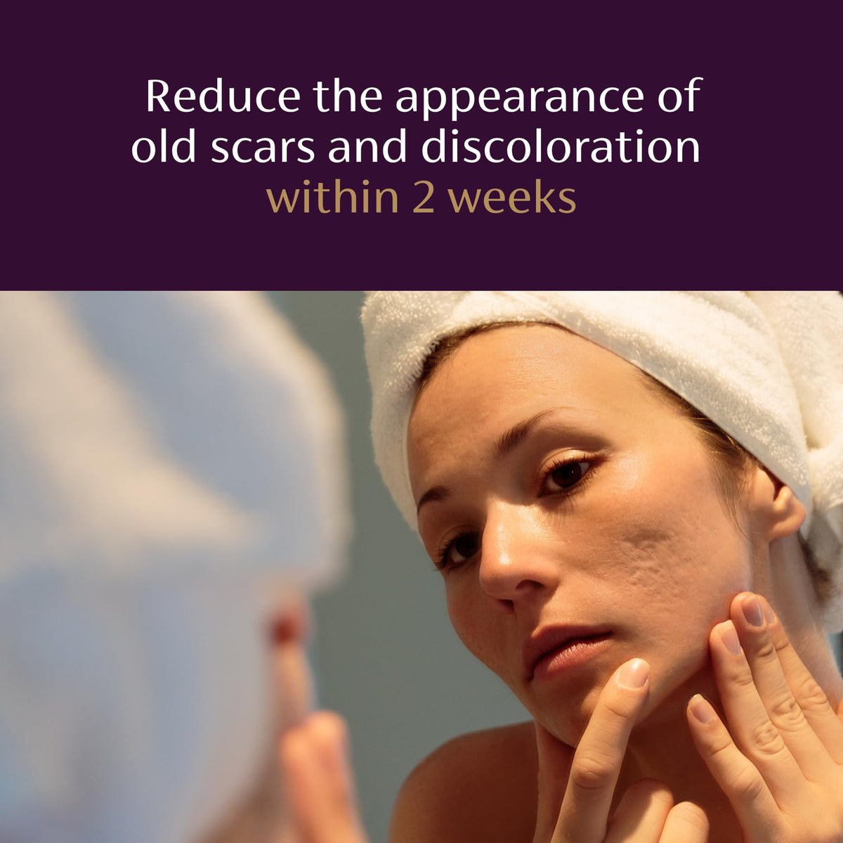 Mederma applied to scar demonstrating targeted use for improved look and texture