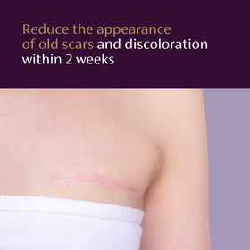 Mederma before and after illustration visualizing gradual scar lightening and smoothing