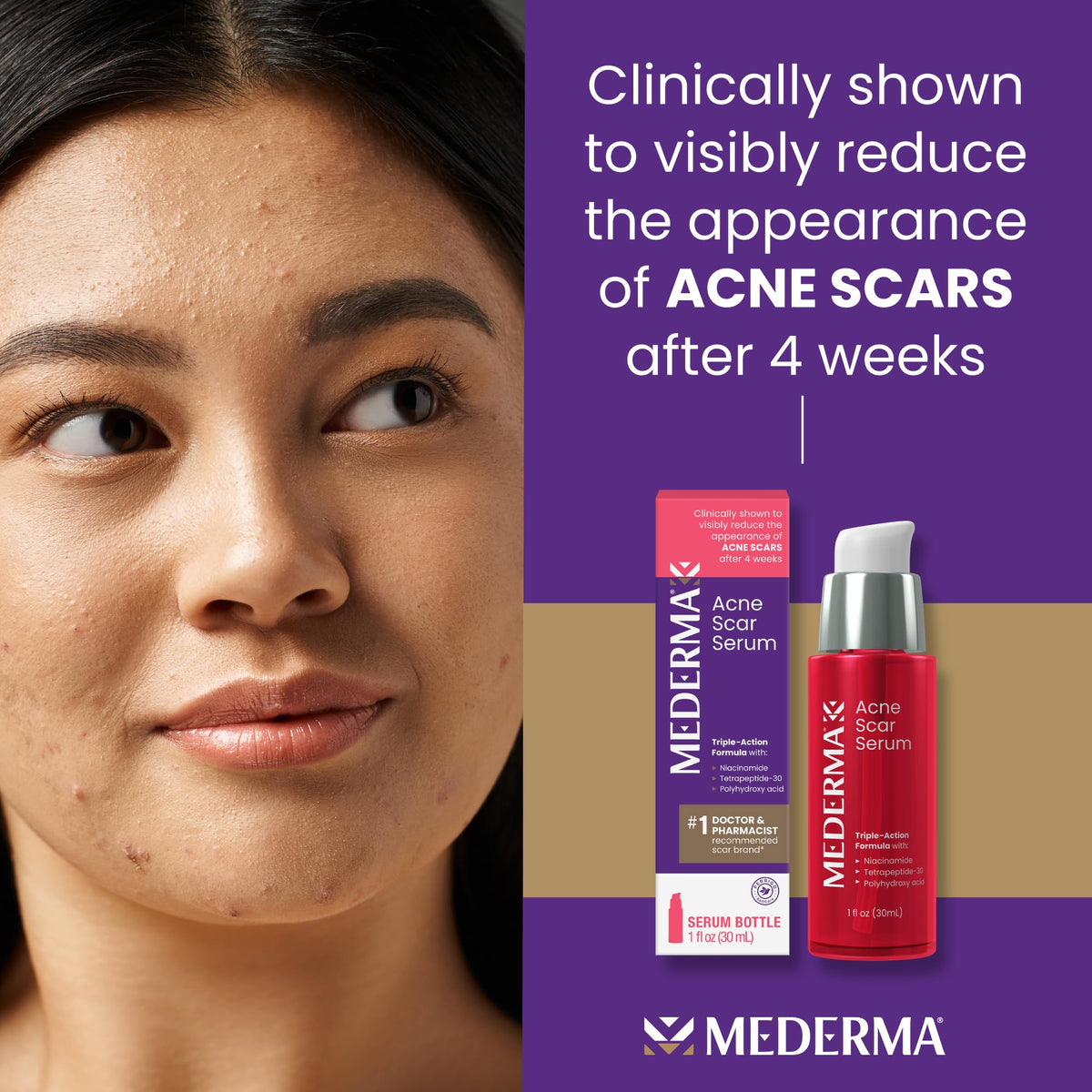 Mederma dropper close-up dispensing serum for precise dosing
