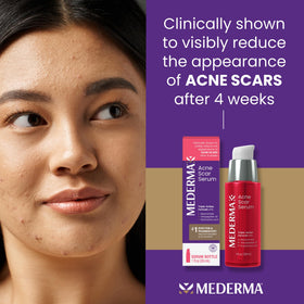 Mederma dropper close-up dispensing serum for precise dosing