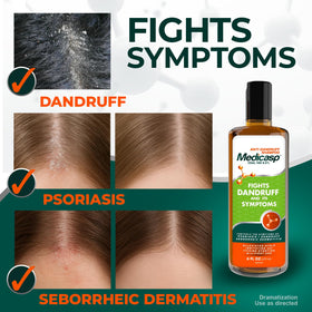Medicasp being massaged into a wet scalp to reduce flakes and soothe itching