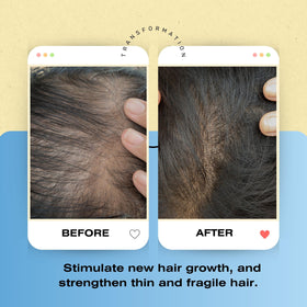 Mediceuticals Bioclenz in-shower usage with hand lathering to reduce mechanical hair stress