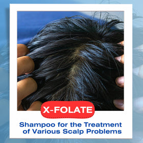 Mediceuticals shampoo dispensing foam from bottle demonstrating easy application