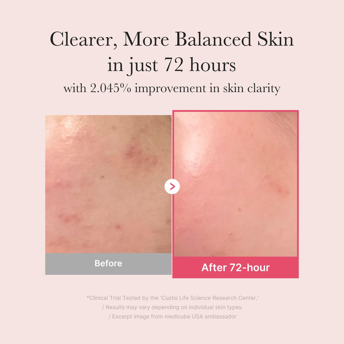 medicube close-up label listing TXA and niacinamide for clarity benefit