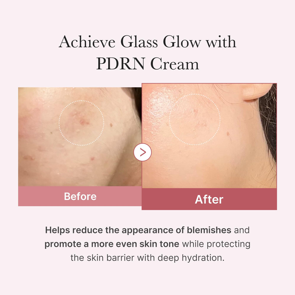 medicube cream applied on hand demonstrating hydration and smooth feel
