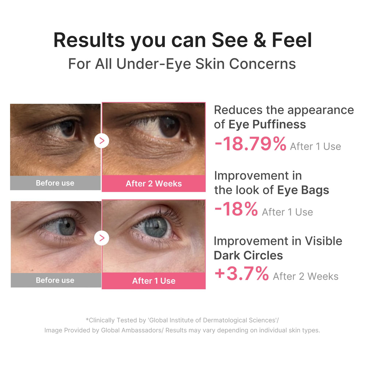 medicube patch applied under eye demonstrating de-puffing and lift effect