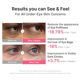 medicube patch applied under eye demonstrating de-puffing and lift effect