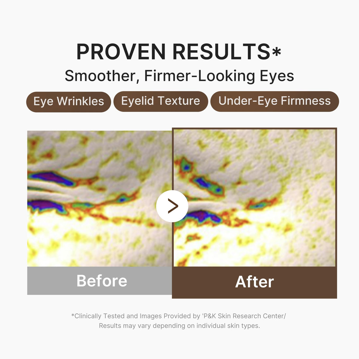 medicube serum application patting eye area demonstrates gentle technique and hydration benefit