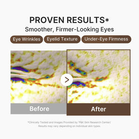 medicube serum application patting eye area demonstrates gentle technique and hydration benefit