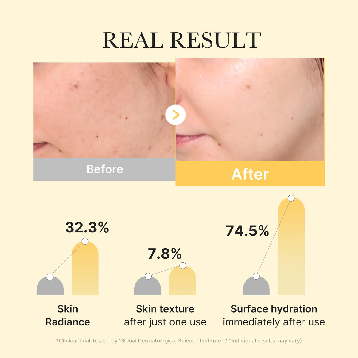 medicube mask applied on face demonstrating comfortable overnight wear