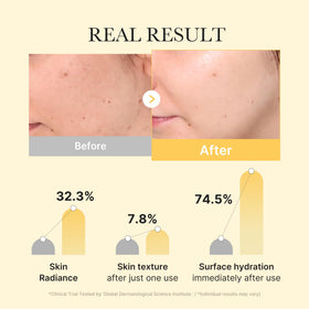 medicube mask applied on face demonstrating comfortable overnight wear