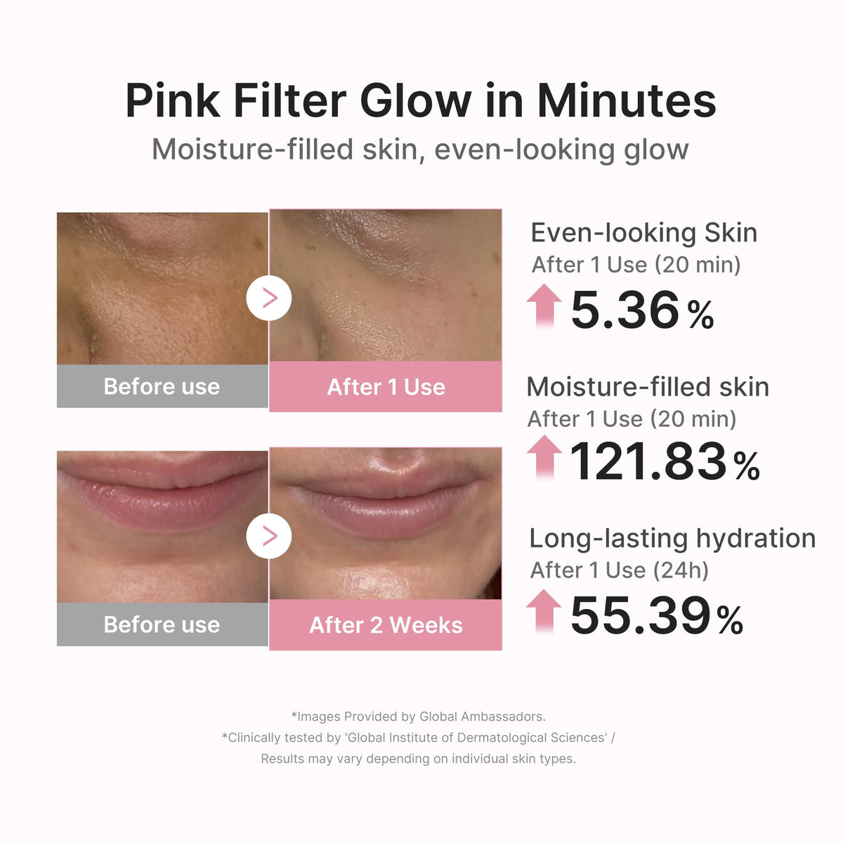 medicube mask applied on model demonstrating gap-free adherence and comfort