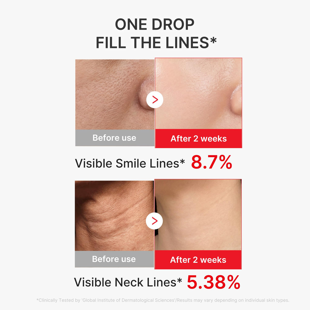 medicube neck application demonstration showing targeted firming benefits on delicate skin