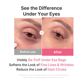 medicube patch applied under eye illustrating cooling effect