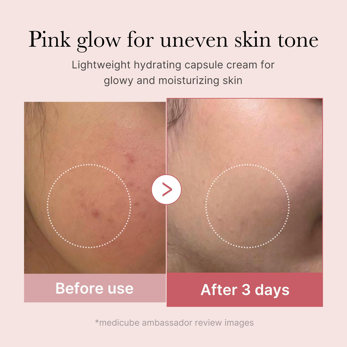 medicube finger pressing capsule to blend actives for immediate use