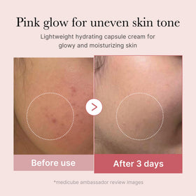 medicube finger pressing capsule to blend actives for immediate use