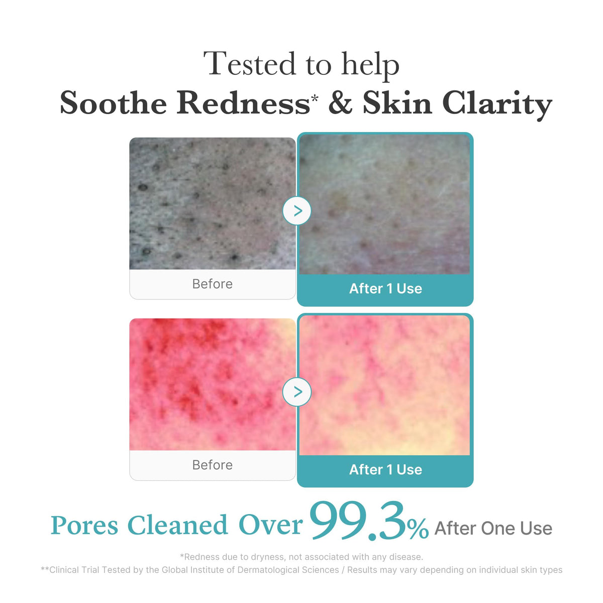 medicube pump dispensing cleanser into hand, illustrates easy controlled application