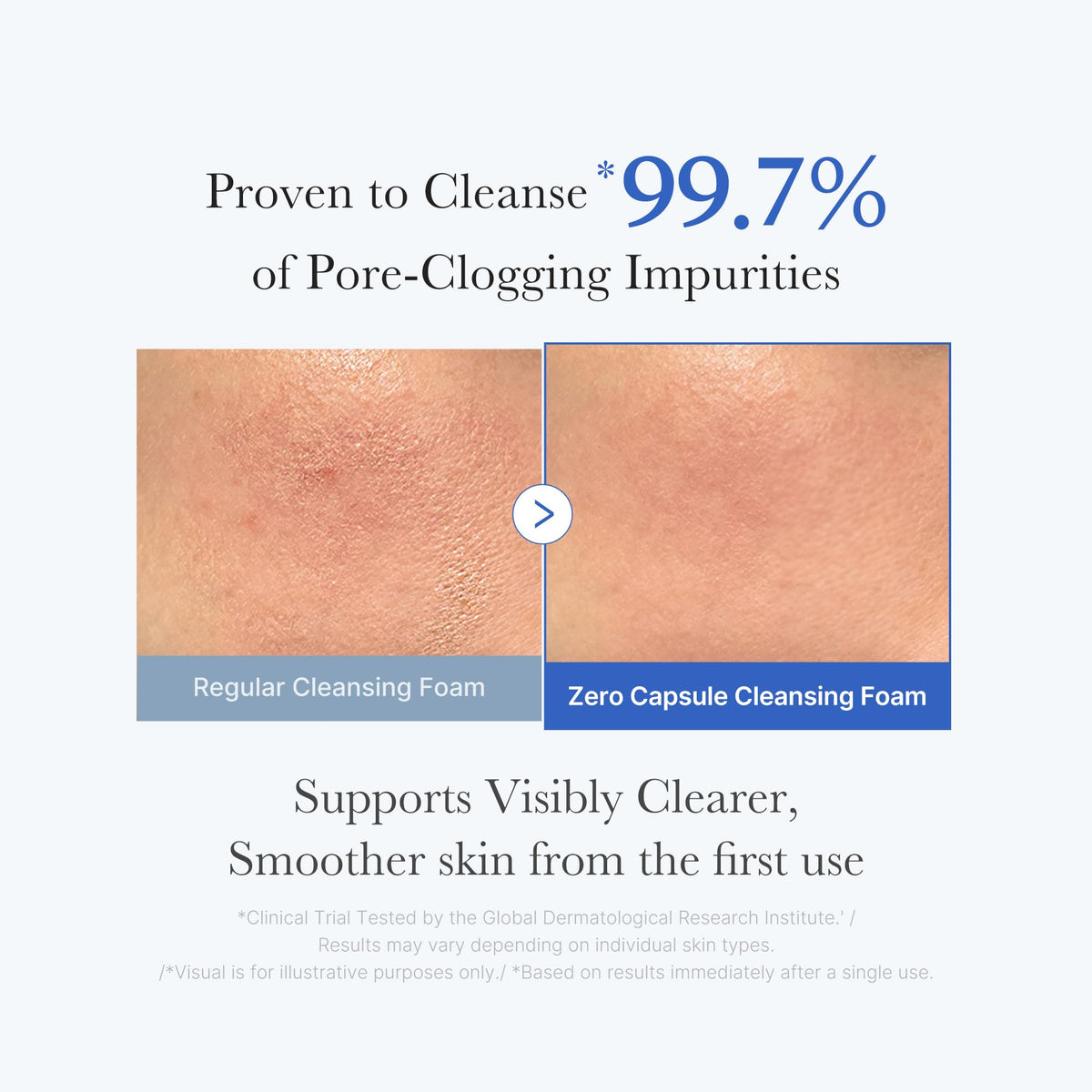 medicube blue capsule macro shot revealing exfoliating beads for pore care