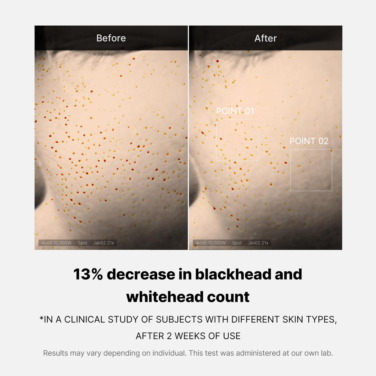 medicube applying serum at night for overnight resurfacing
