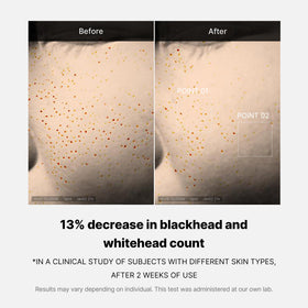 medicube applying serum at night for overnight resurfacing