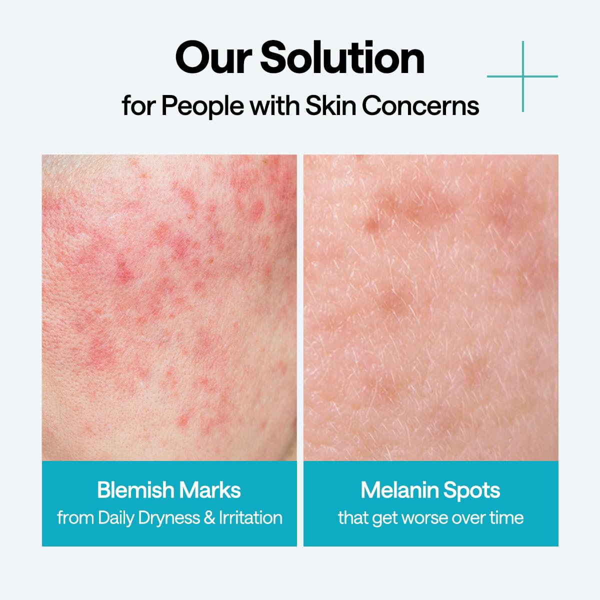 MEDIHEAL mask applied on model showing even fit and visible calming effect