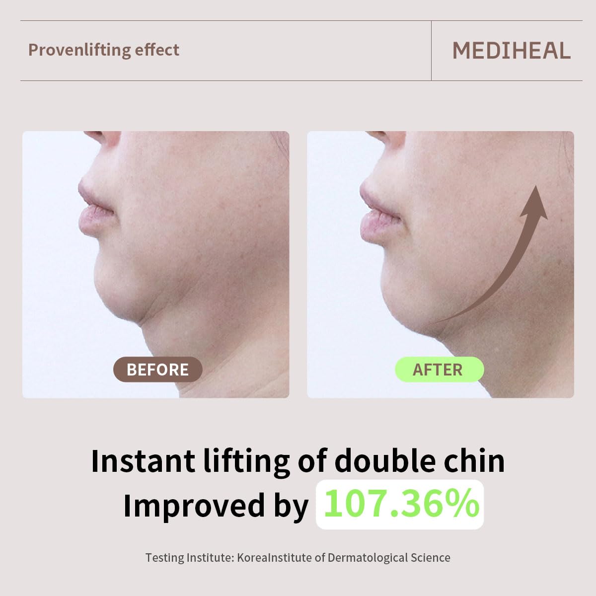 MEDIHEAL before and after scale showing improved jawline appearance