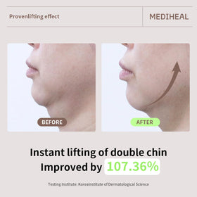 MEDIHEAL before and after scale showing improved jawline appearance