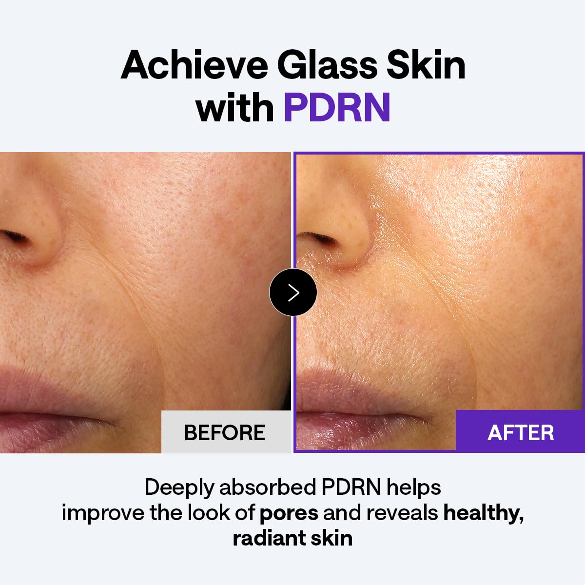 MEDIHEAL Derma Cream ceramide ingredient focus illustrating barrier support