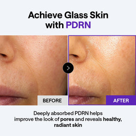 MEDIHEAL Derma Cream ceramide ingredient focus illustrating barrier support