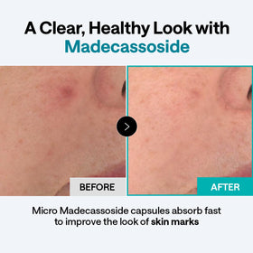 MEDIHEAL product label highlighting madecassoside, niacinamide, squalane