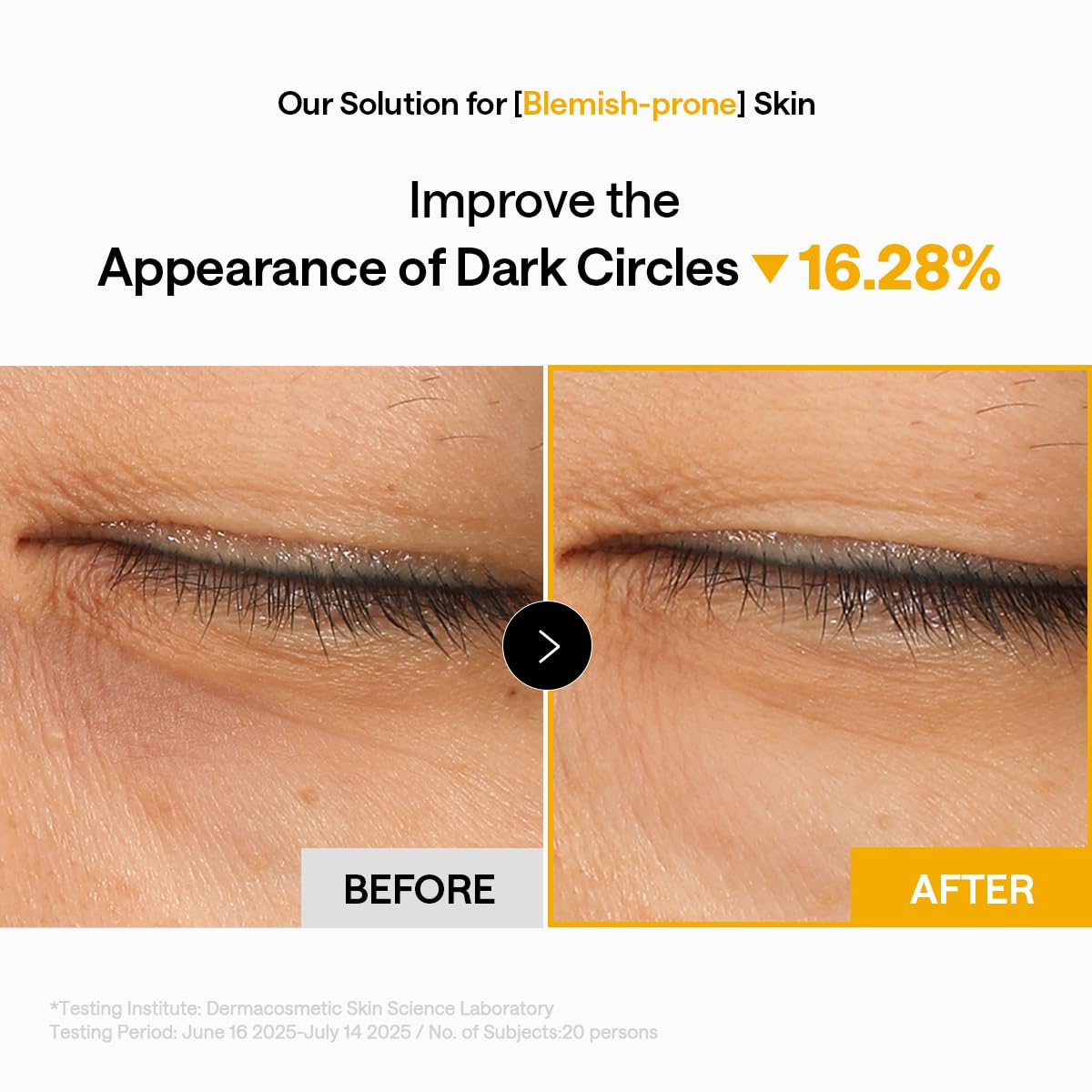 MEDIHEAL patches placed on forehead and smile lines showing multi-zone versatility