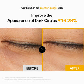 MEDIHEAL patches placed on forehead and smile lines showing multi-zone versatility