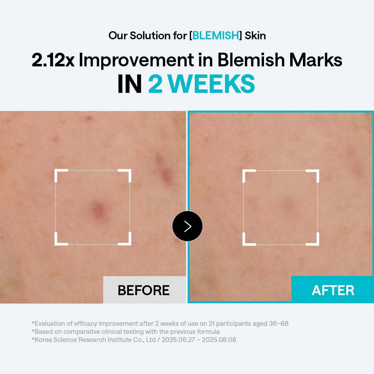 MEDIHEAL pad being swept across cheek to show gentle application and soothing