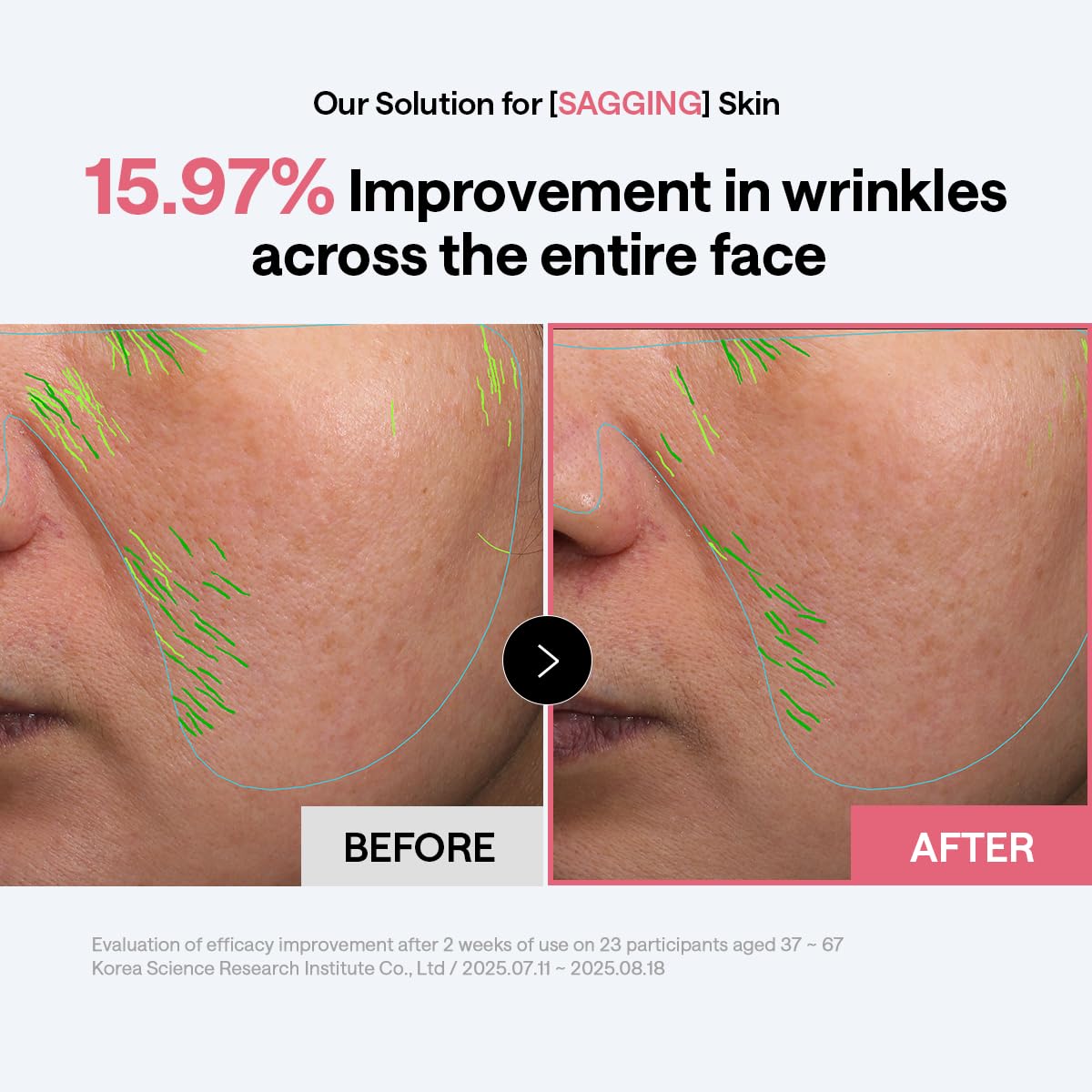MEDIHEAL pad being swiped on cheek for visible smoothing benefit