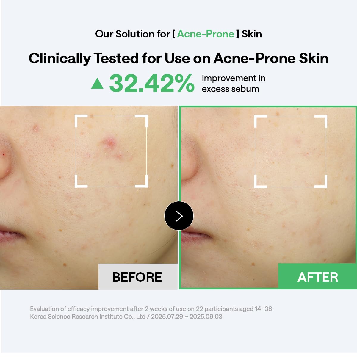MEDIHEAL usage demonstration of a woman wiping face to reduce oil and refresh skin