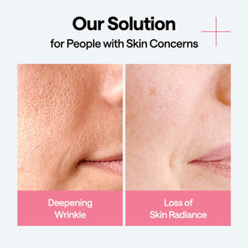 MEDIHEAL mask size comparison with hand to show sheet scale and coverage