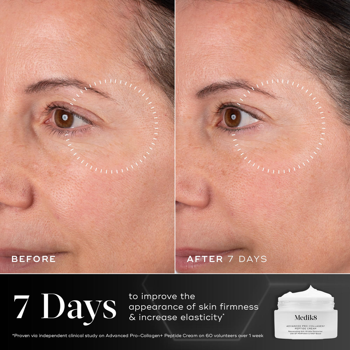 Medik8 cream on fingers demonstrating easy application and absorbency