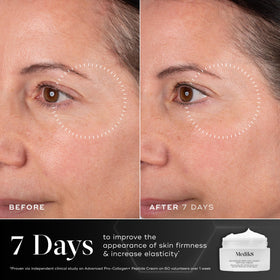 Medik8 cream on fingers demonstrating easy application and absorbency